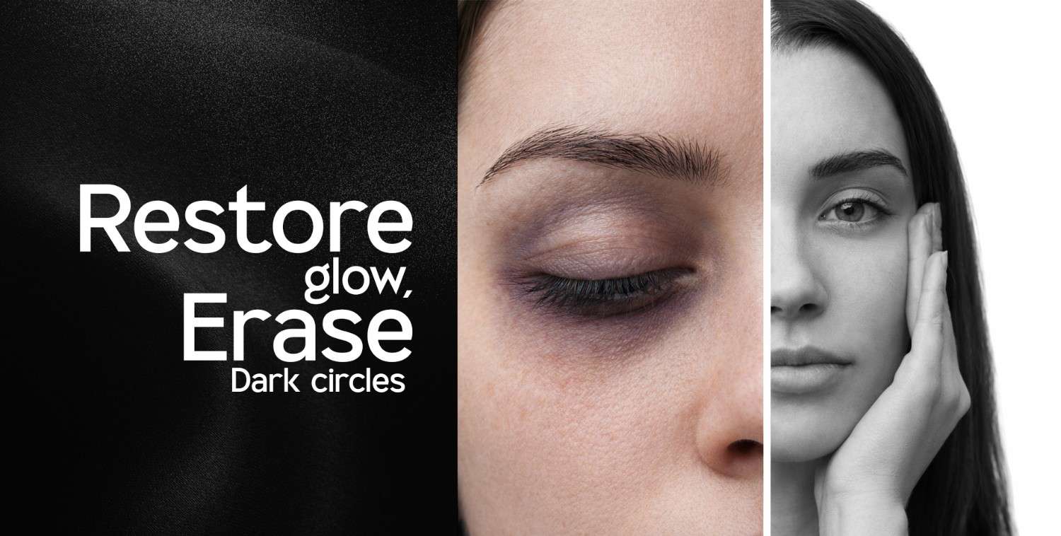Woman's face with severe dark circles under one eye, contrasted with a clear, glowing complexion.