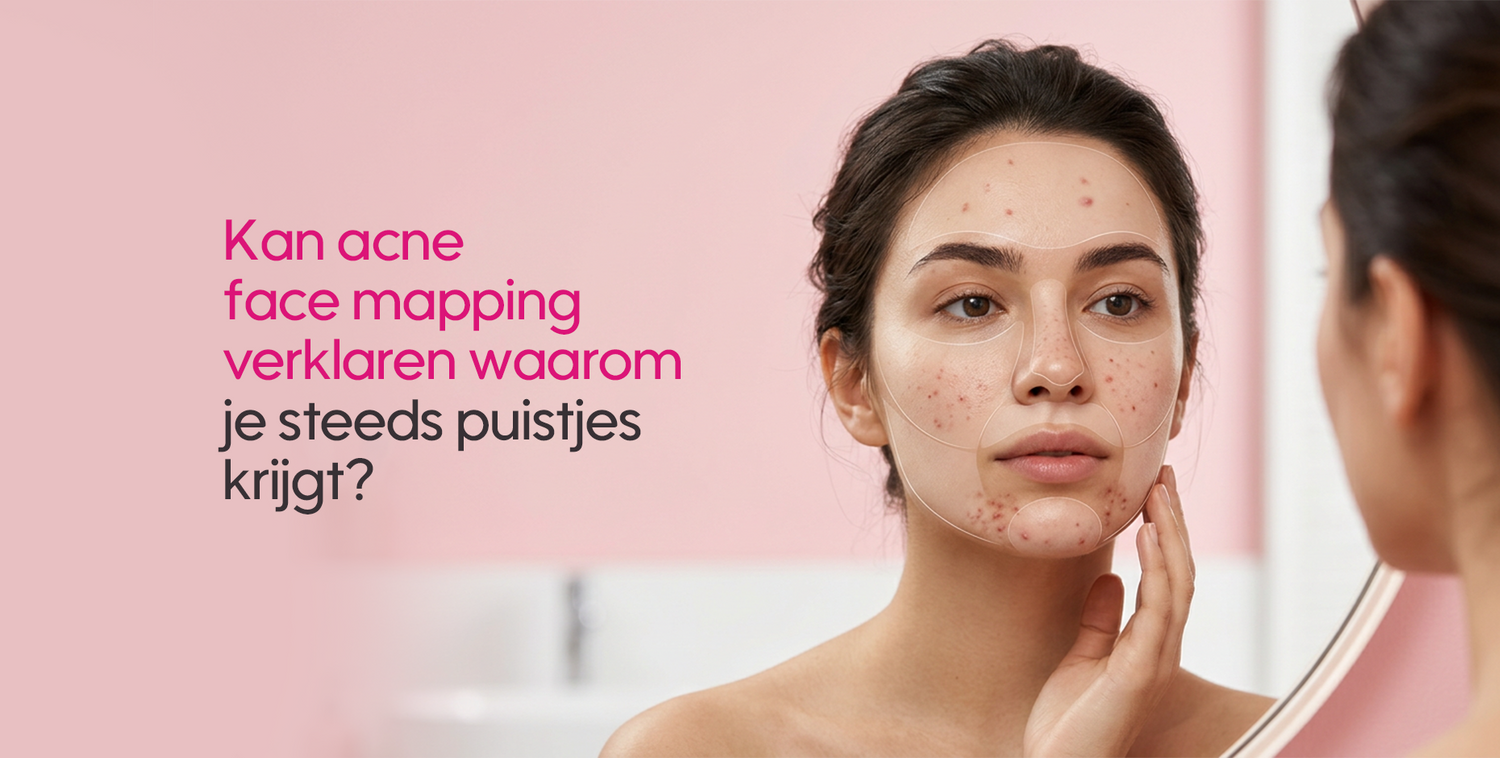 kan-acne-face-mapping-verklaren-waarom-je-steeds-puistjes-krijgt