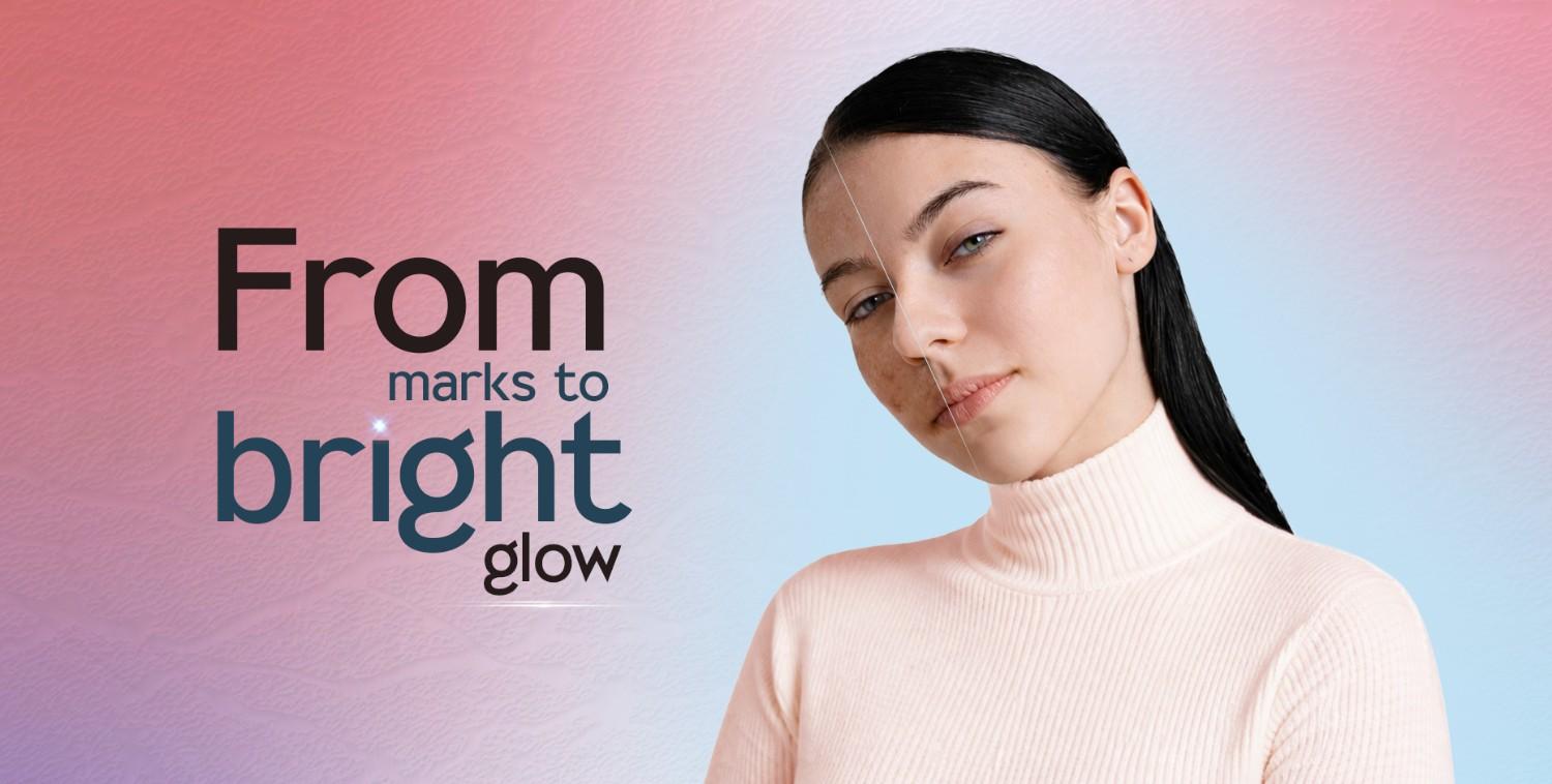 Hyperpigmentation