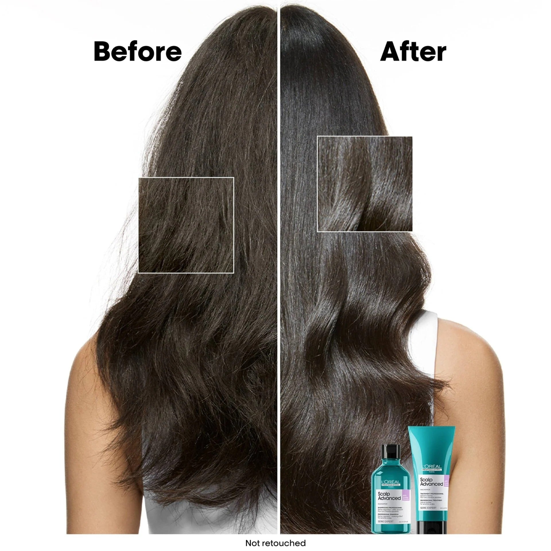 L'Oréal Professionnel Scalp Advanced Professional Shampoo Refill 500ml-Scalp Care Shampoo-Aladin Beauty
