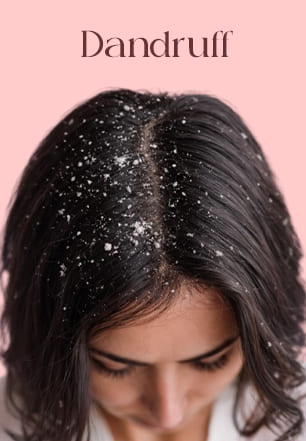 women with dandruff Hair Concerns